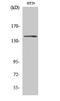 Colony Stimulating Factor 1 Receptor antibody, STJ92246, St John