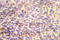 CFL1 antibody, AP21021PU-N, Origene, Immunohistochemistry paraffin image 