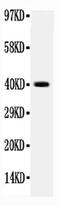 Integrin Subunit Beta 4 antibody, PA5-79541, Invitrogen Antibodies, Western Blot image 