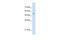 Serine Hydroxymethyltransferase 2 antibody, 30-164, ProSci, Western Blot image 