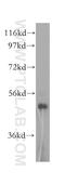 Keratin 80 antibody, 16835-1-AP, Proteintech Group, Western Blot image 
