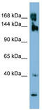 Serine/threonine-protein kinase WNK3 antibody, TA346679, Origene, Western Blot image 