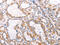 TNF Receptor Associated Factor 5 antibody, CSB-PA146040, Cusabio, Immunohistochemistry paraffin image 