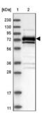 Mitogen-Activated Protein Kinase Kinase Kinase 2 antibody, NBP2-48554, Novus Biologicals, Western Blot image 