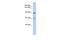 G Protein-Coupled Receptor Associated Sorting Protein 2 antibody, A11911, Boster Biological Technology, Western Blot image 