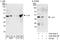 Jun Proto-Oncogene, AP-1 Transcription Factor Subunit antibody, A302-959A, Bethyl Labs, Western Blot image 