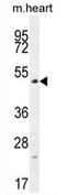 TSPY Like 4 antibody, AP54386PU-N, Origene, Western Blot image 