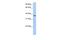 Transmembrane And Coiled-Coil Domain Family 1 antibody, PA5-42627, Invitrogen Antibodies, Western Blot image 