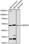 G-Patch Domain And KOW Motifs antibody, A11892, Boster Biological Technology, Western Blot image 