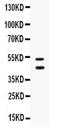 Protein C Receptor antibody, PA5-79882, Invitrogen Antibodies, Western Blot image 