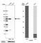 Acyl-CoA Binding Domain Containing 5 antibody, NBP1-85146, Novus Biologicals, Western Blot image 