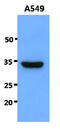 Snail Family Transcriptional Repressor 1 antibody, MBS200311, MyBioSource, Western Blot image 