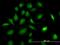 Phosphoribosylglycinamide Formyltransferase, Phosphoribosylglycinamide Synthetase, Phosphoribosylaminoimidazole Synthetase antibody, orb89588, Biorbyt, Immunofluorescence image 