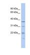 Malignant T cell-amplified sequence 1 antibody, NBP1-58236, Novus Biologicals, Western Blot image 