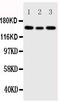 Insulin Like Growth Factor 1 Receptor antibody, PA1746, Boster Biological Technology, Western Blot image 