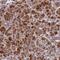 Armadillo Repeat Containing 6 antibody, PA5-59673, Invitrogen Antibodies, Immunohistochemistry frozen image 