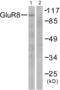 Glutamate Metabotropic Receptor 8 antibody, abx013096, Abbexa, Western Blot image 