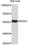 NADPH Oxidase 1 antibody, A11966, ABclonal Technology, Western Blot image 
