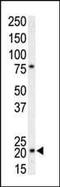 p21 antibody, PA5-14456, Invitrogen Antibodies, Western Blot image 