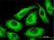 Tubulin Alpha 1c antibody, H00084790-M01, Novus Biologicals, Immunofluorescence image 