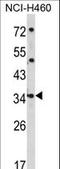 Cerberus 1, DAN Family BMP Antagonist antibody, LS-C168687, Lifespan Biosciences, Western Blot image 