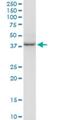 Heat Shock Transcription Factor 2 Binding Protein antibody, H00011077-M01, Novus Biologicals, Western Blot image 