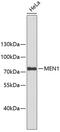 Menin 1 antibody, 13-592, ProSci, Western Blot image 