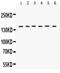 Rho Associated Coiled-Coil Containing Protein Kinase 2 antibody, LS-C357576, Lifespan Biosciences, Western Blot image 