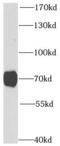 Protein Kinase CGMP-Dependent 1 antibody, FNab06786, FineTest, Western Blot image 