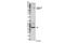 Spleen Associated Tyrosine Kinase antibody, 14140S, Cell Signaling Technology, Western Blot image 