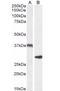 Uncoupling Protein 2 antibody, orb19468, Biorbyt, Western Blot image 