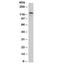 Cadherin 3 antibody, 33-693, ProSci, Western Blot image 