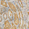 NADPH Oxidase 4 antibody, A2201, ABclonal Technology, Immunohistochemistry paraffin image 
