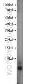 Gene differentially expressed in prostate protein antibody, 22744-1-AP, Proteintech Group, Western Blot image 