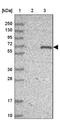 Testis Specific Serine Kinase Substrate antibody, NBP1-92539, Novus Biologicals, Western Blot image 