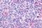 Cholinergic Receptor Muscarinic 4 antibody, GTX71307, GeneTex, Immunohistochemistry paraffin image 
