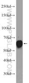 Glycerophosphodiester Phosphodiesterase Domain Containing 2 antibody, 25074-1-AP, Proteintech Group, Western Blot image 