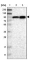 ElaC Ribonuclease Z 2 antibody, PA5-54016, Invitrogen Antibodies, Western Blot image 