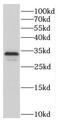 Chromosome 9 Open Reading Frame 78 antibody, FNab01150, FineTest, Western Blot image 
