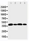Aurora Kinase B antibody, LS-C312951, Lifespan Biosciences, Western Blot image 