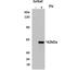 LCK Proto-Oncogene, Src Family Tyrosine Kinase antibody, NBP2-36789, Novus Biologicals, Western Blot image 