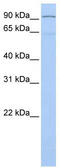 Leucine Zipper Like Transcription Regulator 1 antibody, TA343636, Origene, Western Blot image 