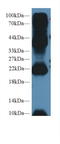 Anterior Gradient 2, Protein Disulphide Isomerase Family Member antibody, LS-C292870, Lifespan Biosciences, Western Blot image 