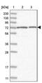 Solute Carrier Family 12 Member 8 antibody, PA5-56650, Invitrogen Antibodies, Western Blot image 