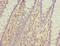 Polypeptide N-Acetylgalactosaminyltransferase 2 antibody, LS-C675790, Lifespan Biosciences, Immunohistochemistry paraffin image 