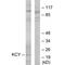Cytidine/Uridine Monophosphate Kinase 1 antibody, PA5-49800, Invitrogen Antibodies, Western Blot image 