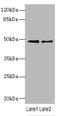 Inositol Hexakisphosphate Kinase 2 antibody, LS-C675910, Lifespan Biosciences, Western Blot image 