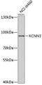 Small conductance calcium-activated potassium channel protein 3 antibody, 22-016, ProSci, Western Blot image 