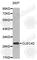 C-Type Lectin Domain Family 4 Member D antibody, A2697, ABclonal Technology, Western Blot image 