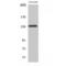 Caspase Recruitment Domain Family Member 11 antibody, LS-C382428, Lifespan Biosciences, Western Blot image 